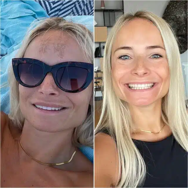 Produkta opcijas attēls